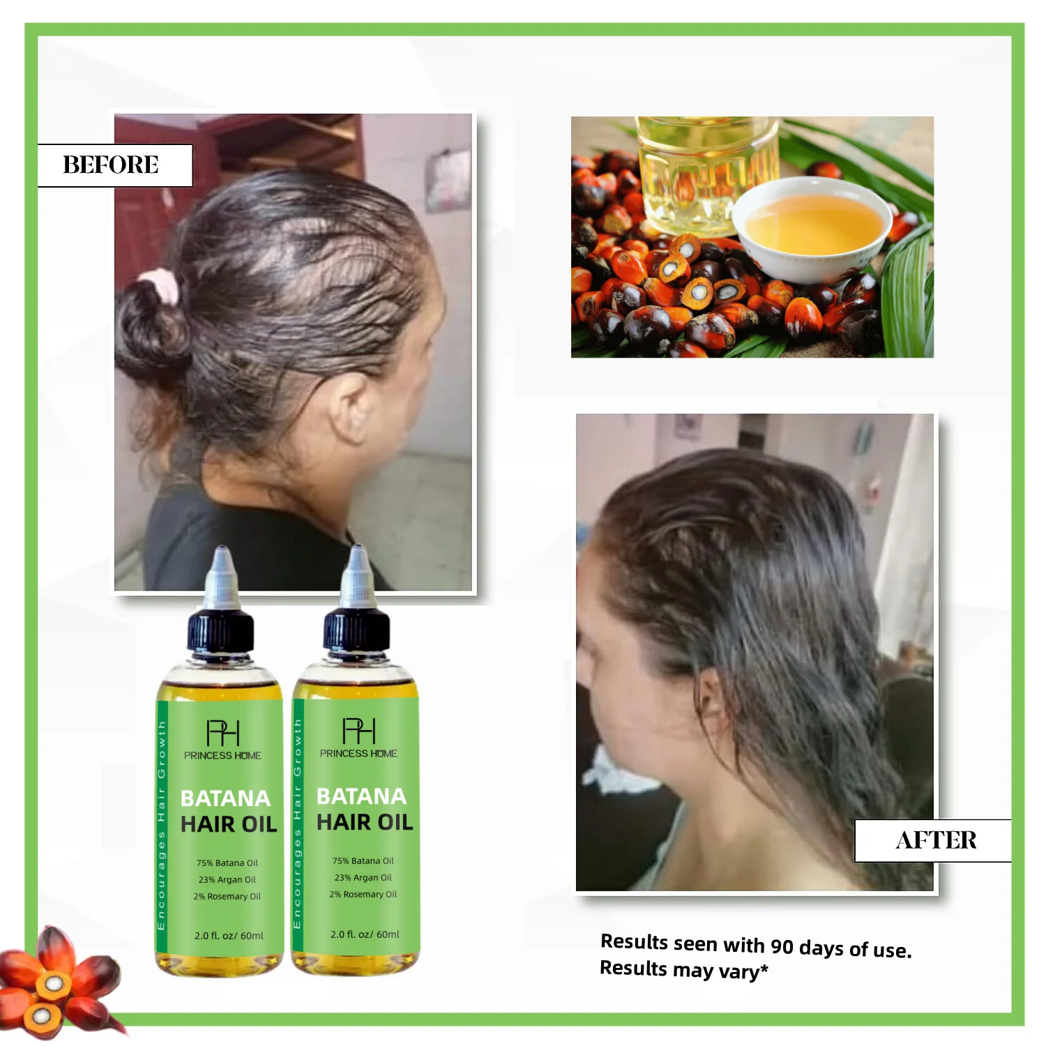 kf-S9097e30ab8664bad863cf682890913e79-Hair-Growth-Oil-Fenugreek-Anti-Hair-Loss-Oil-Rosemary-Hair-Regrowth-Batana-Butter-Hair-Growth-Products