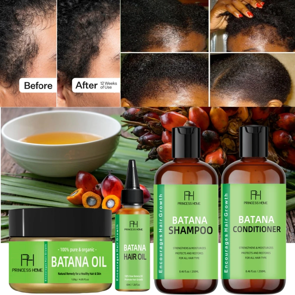 kf-Sd045264c198045619468f67f89055390m-Hair-Growth-Oil-Fenugreek-Anti-Hair-Loss-Oil-Rosemary-Hair-Regrowth-Batana-Butter-Hair-Growth-Products