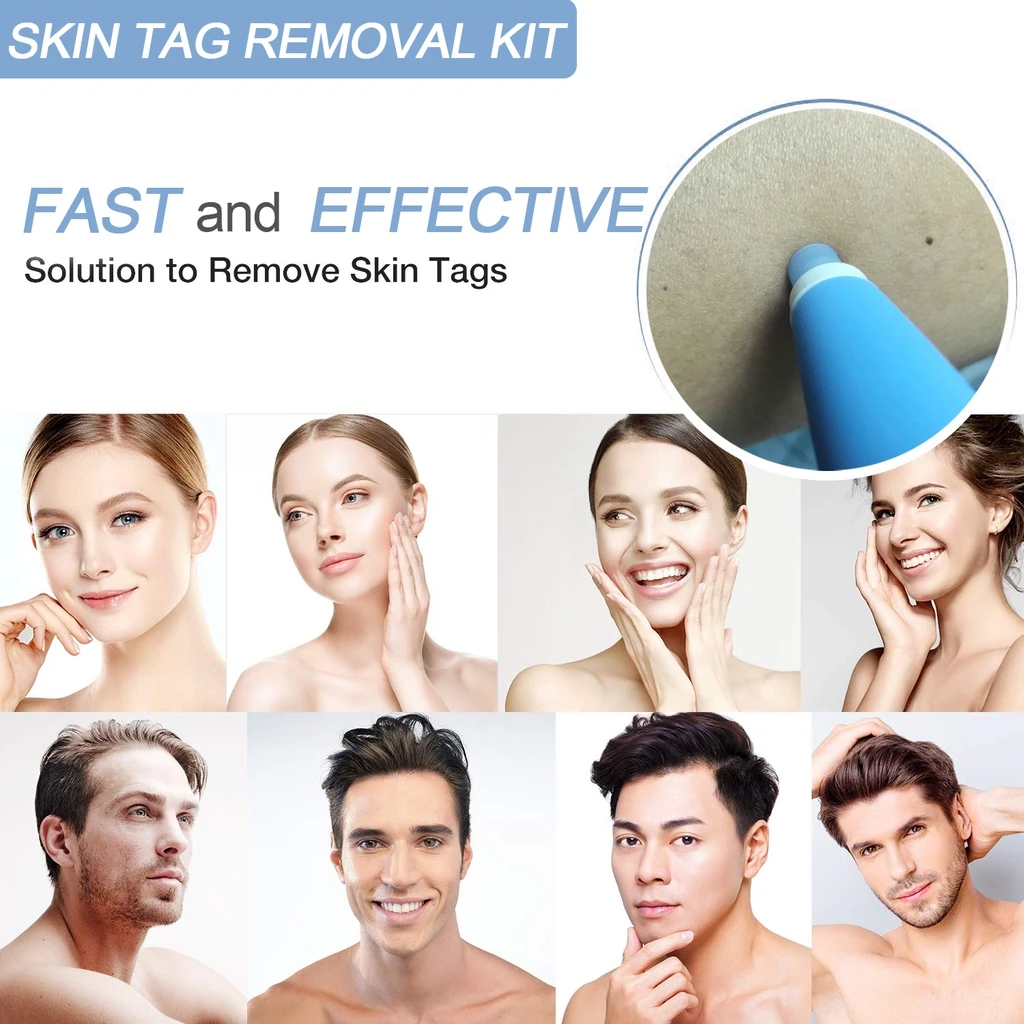 kf-H9a0dfe5e3fc74bf5a1d38ad922476d177-Skin-Tag-Kill-Skin-Mole-Wart-Remover-Micro-Skin-Tag-Removal-Kit-With-Cleansing-Swabs-Adult