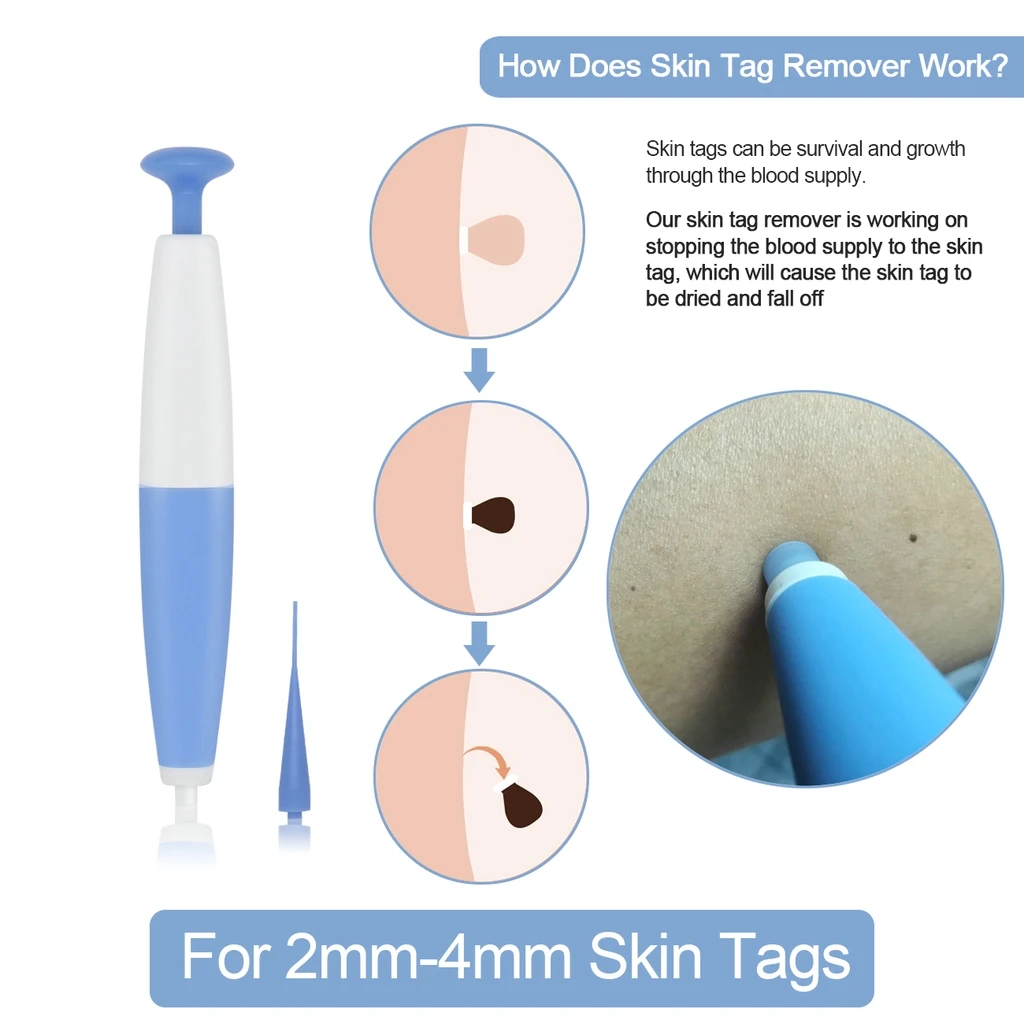 kf-He272980b54c44ed89e70e9c966cf7bdb8-Skin-Tag-Kill-Skin-Mole-Wart-Remover-Micro-Skin-Tag-Removal-Kit-With-Cleansing-Swabs-Adult