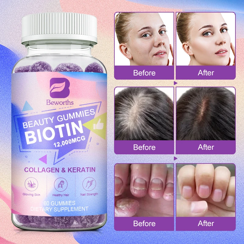 kf-Se359d43ce9914983aa0b7ab1ee7cecd1t-Vitamin-Biotin-Gummies-12-000-mcg-for-Stronger-Hair-Skin-Nails-60-Gummies